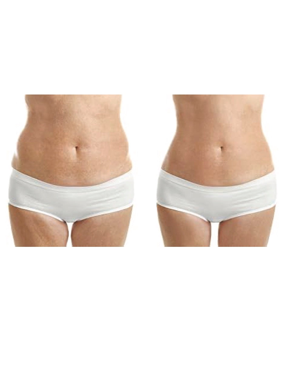 Crema Anti-Estrías - Natural - Sin químicos - Estrías embarazo - Contenido 90ml. (3.04oz) - - Hannah White 