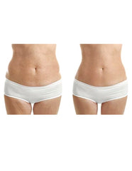 Crema Anti-Estrías - Natural - Sin químicos - Estrías embarazo - Contenido 90ml. (3.04oz) - - Hannah White 