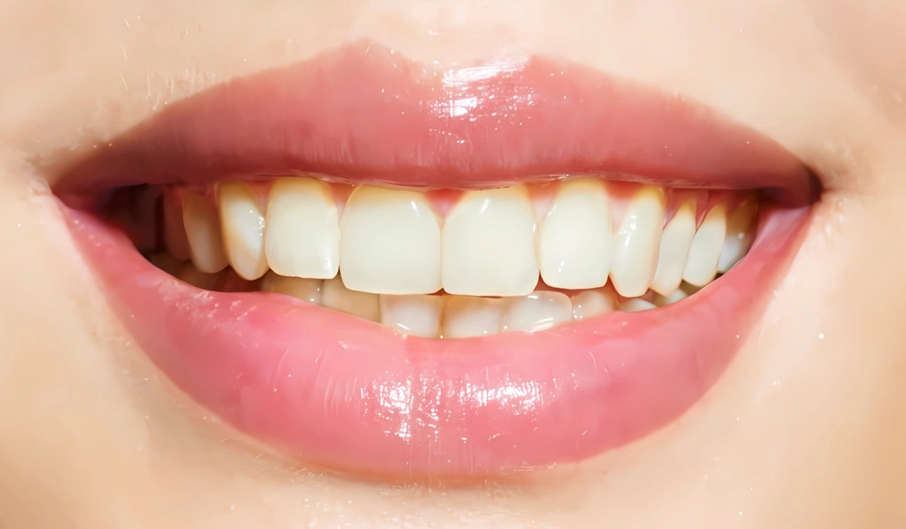 Gel Blanqueador Dental con Carbón Activado - 100% Garantizado