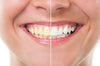 Blanqueador Dental Carbón Activado - 100% NATURAL - (20g) - Hannah White 
