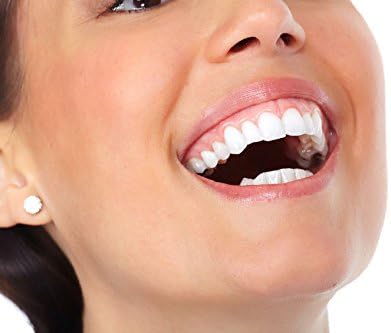 Blanqueador Dental Carbón Activado - 100% NATURAL - (20g) - Hannah White 