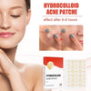 Parche Invisible para el cuidado de la piel granos y acné hidrocoloidal - Hannah White 
